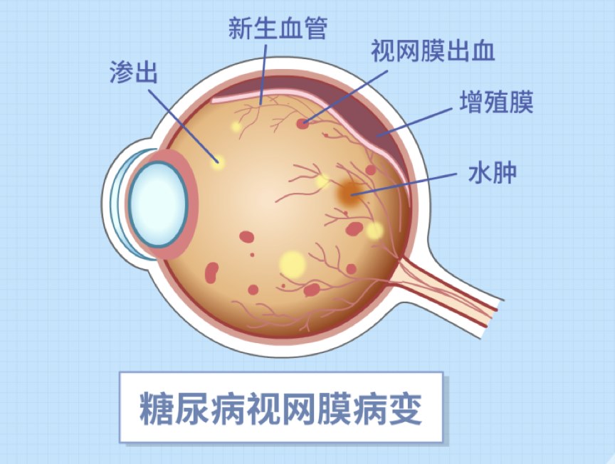 圖片.png 圖片.png