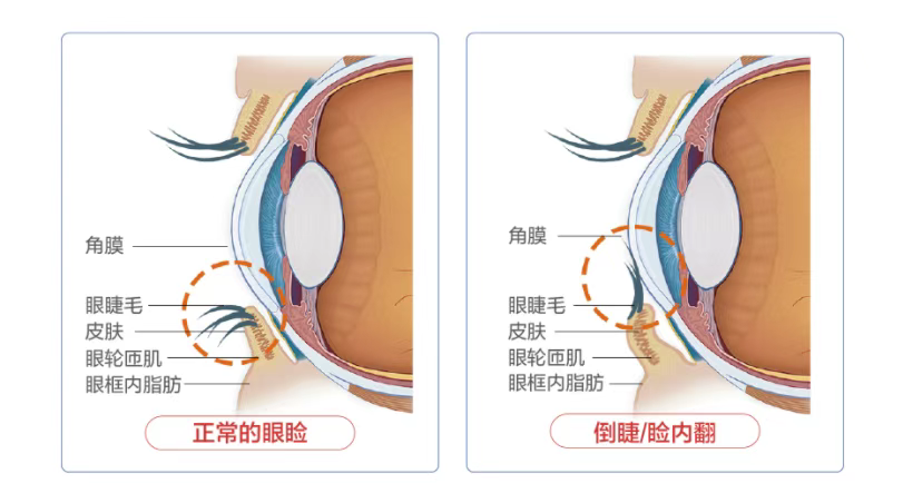 圖片.png 圖片.png